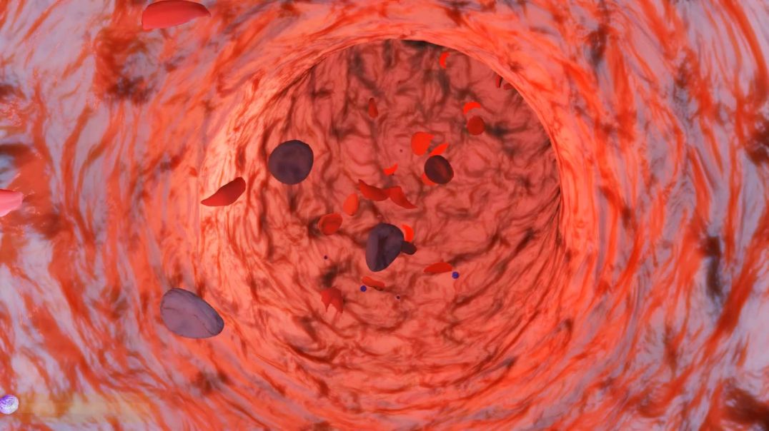 The Bone Marrow - Spongy substance found in center of bones - [Hindi] - Infi_Full-HD