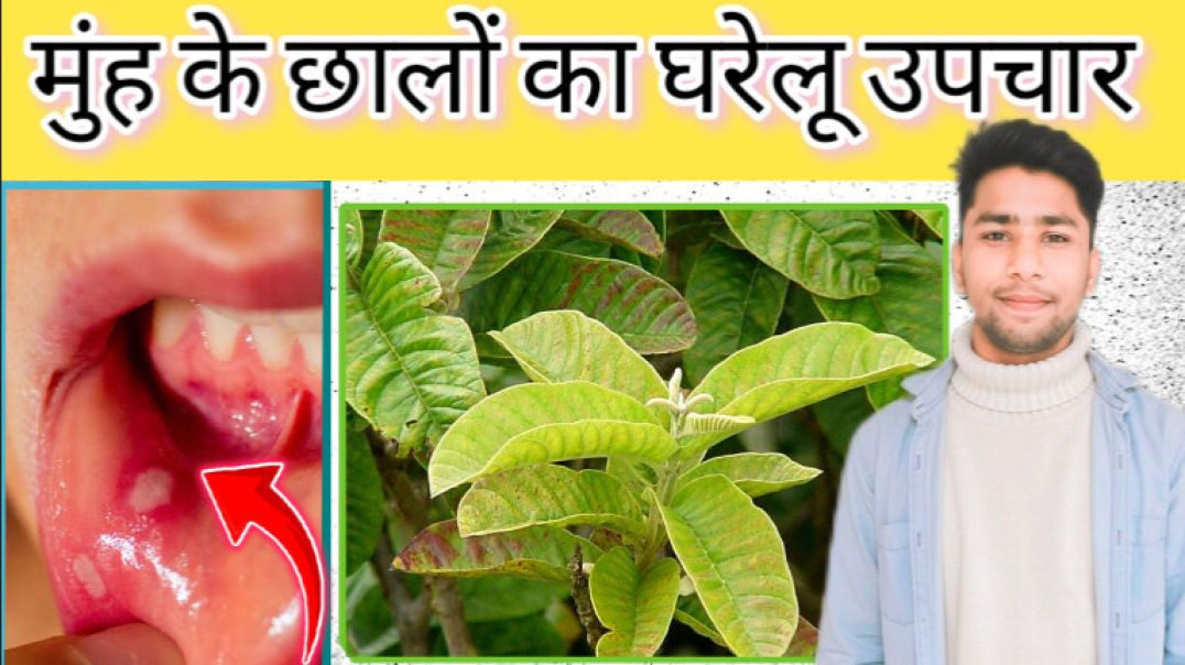 ⁣Muh ke chhale thik kare ll aayurvedik upchar ll #aayuvedic