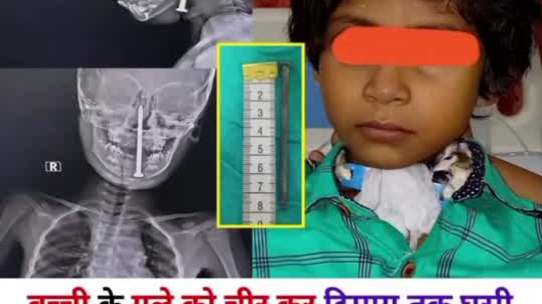 ⁣subscribe for more facts 💯 #facts #news #motivation #shorts #shortsfeed #shortvideo #youtubeshorts