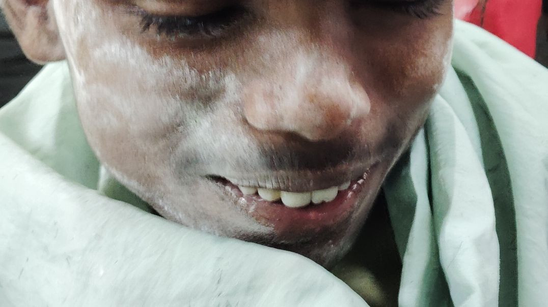 ⁣New istail video|funny videos 🤣