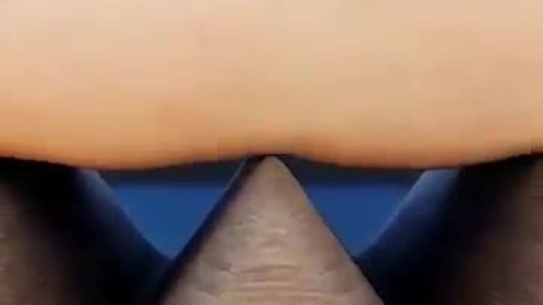 ⁣Big_Stone_on_Man_Leg_🪨_#shorts_#shortvideo_#ytshorts_#facts(360p)