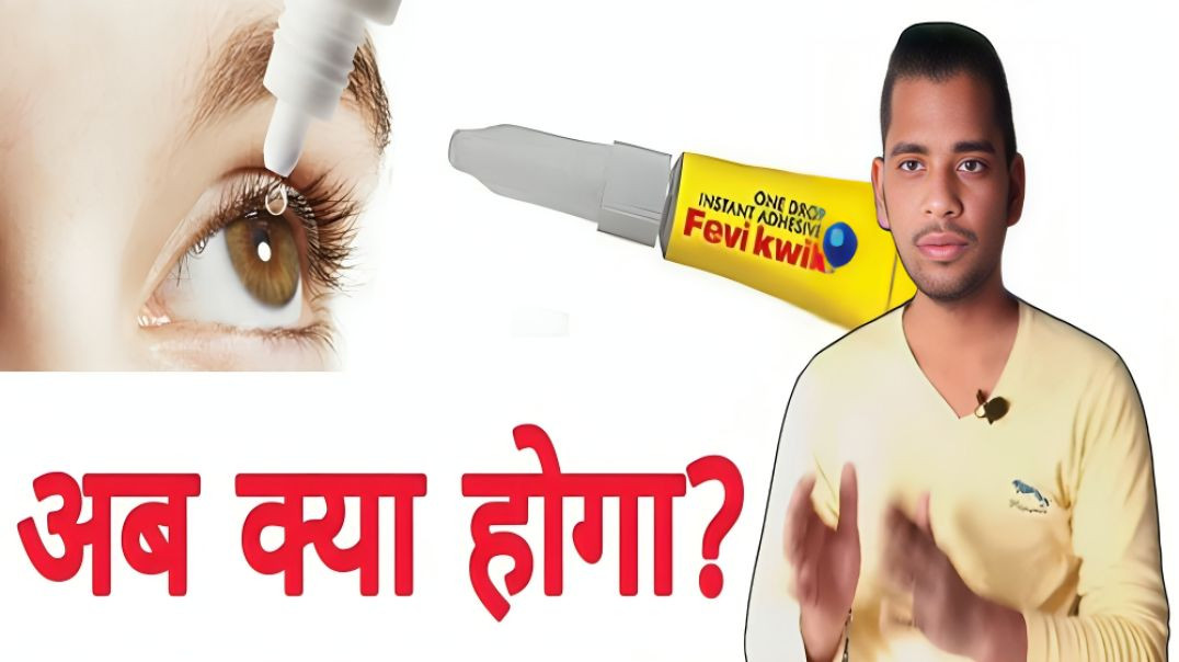 ⁣फेवीक्विक आंखी ने चली जाए तो | feviquick aankho me chali jaaye to | AC Prashant