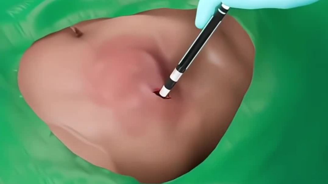 ⁣पेड़ के अंदर मछली कहार आय देखिए 3D एनीमेशन से #facts #3danimation