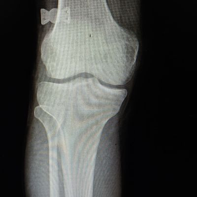 112776597737377783233 