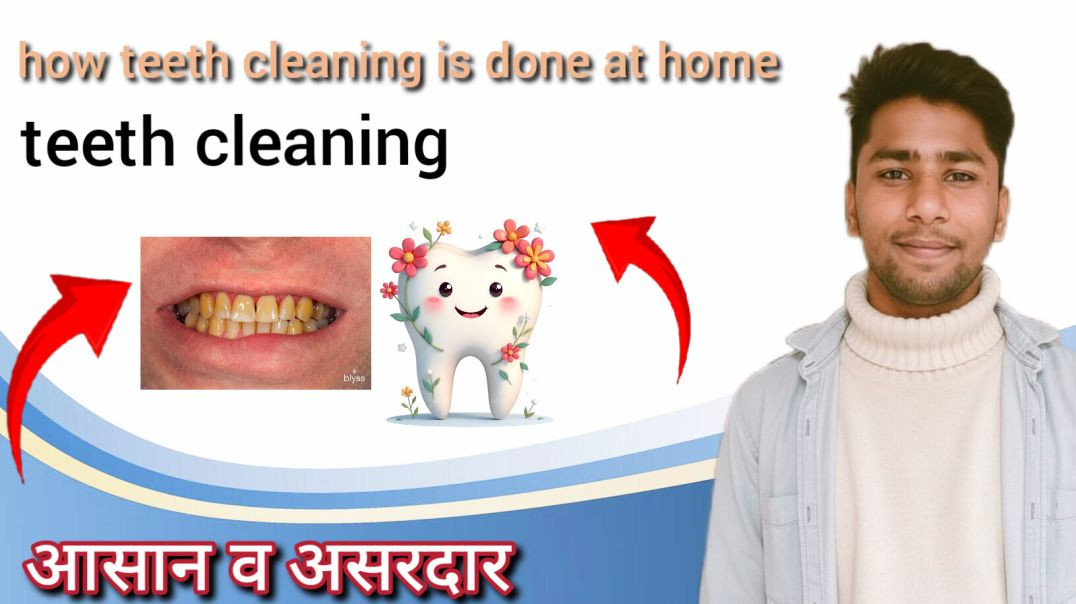 ⁣teeth cleaning by doctor video