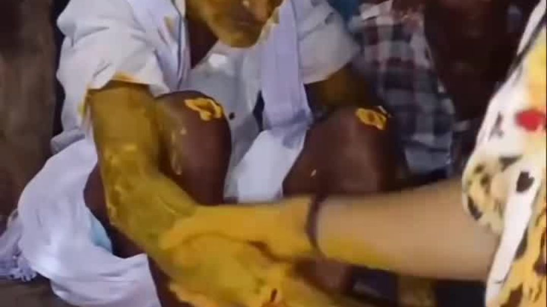 AQNfKJzkHGFijQX1B225OE1PlVqSxxIFzcOWV2XyoNujs5OcWzhulJg1iAC-VRvgE1jnFaN41fqeokNX-APEIsbWXTV6jR-6