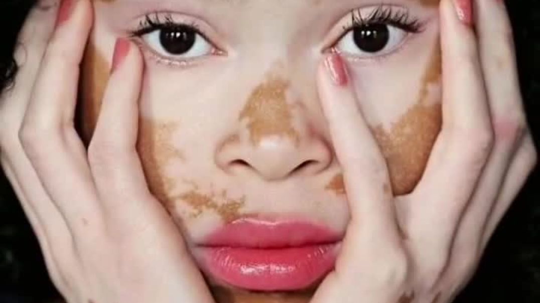 ⁣मेकअप नहीं, अब काम करेगा ये देसी नुस्खा—दाग ढके नहीं, कम करें!