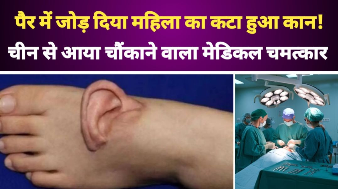 ⁣पैर में जोड़ दिया महिला का कान और फिर. चीन से आया हैरान करने वाला मामला, सच्चाई जान उड़ जाएंगे होश