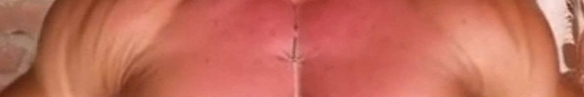 100077635503567813438 