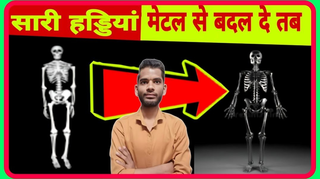 ⁣If all Bones are Replaced with Titanium || AC Prashant