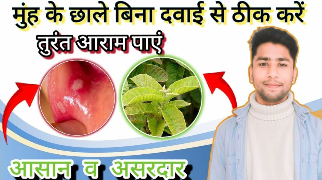 ⁣मुंह के छाले ठीक करें ll मुंह के छालें में रहते पाए