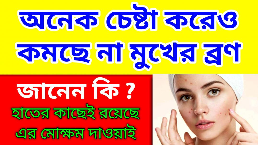মুখে ব্রণ হওয়ার কারণ কি? | Pimple Problem