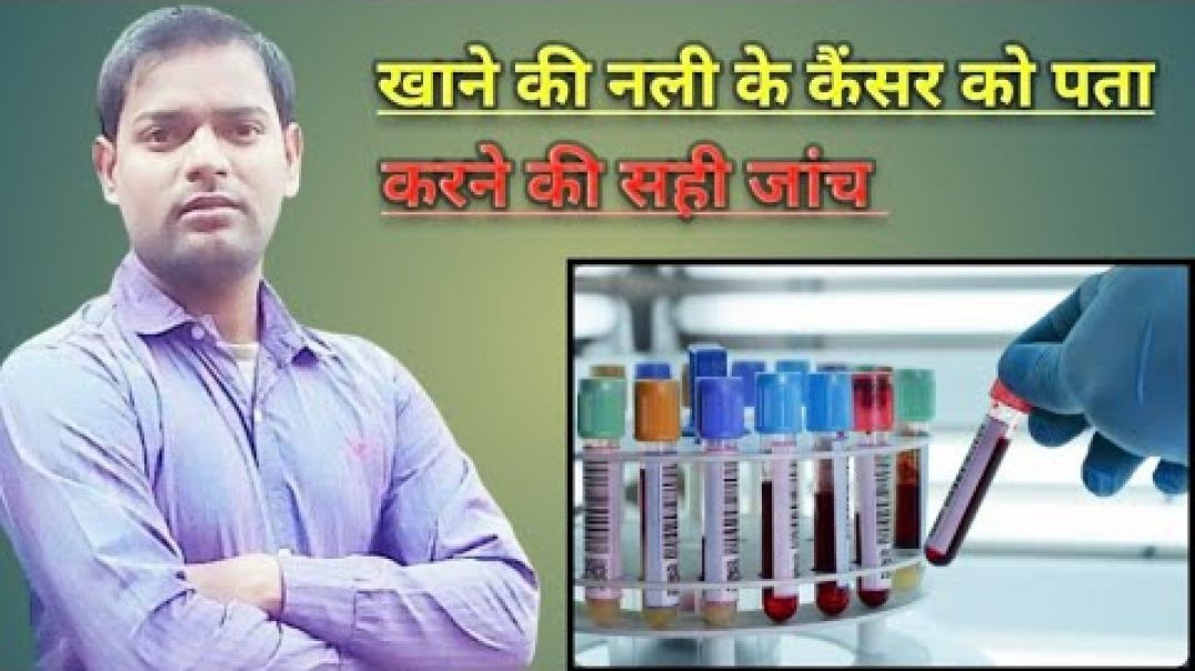 ⁣Esophageal cancer test । खाने की नली के कैंसर को पता करने की सही जांच ।(720P_HD)