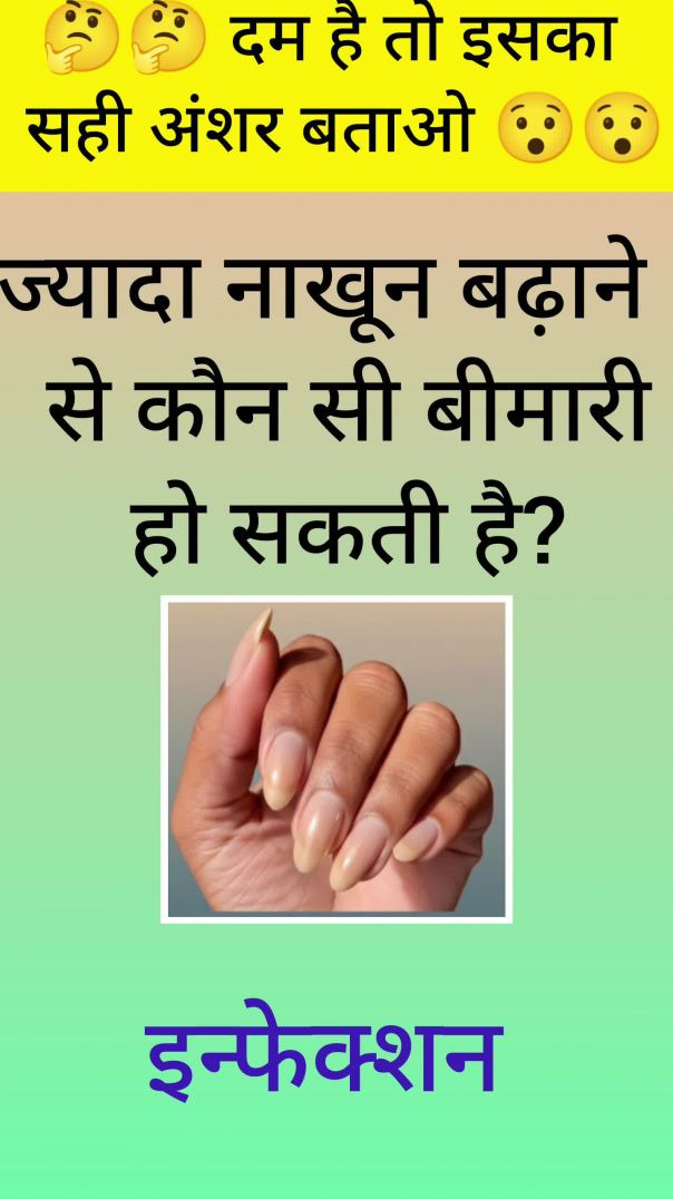 Gkviedo #viralshorts