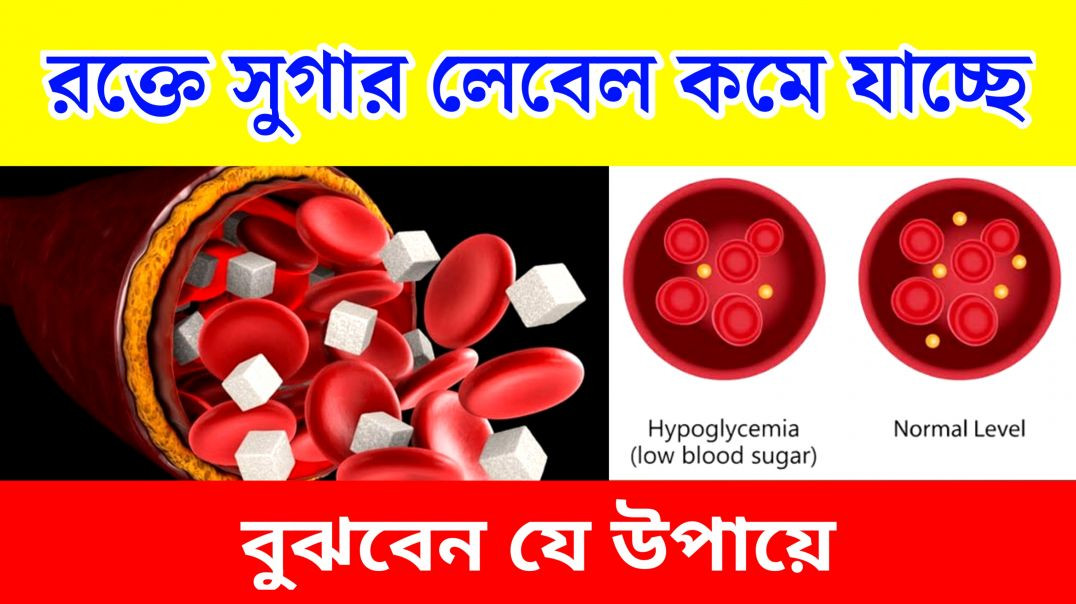 রক্তে সুগার লেবেল কমে যাচ্ছে বুঝবেন কিভাবে ? | Low Blood Sugar