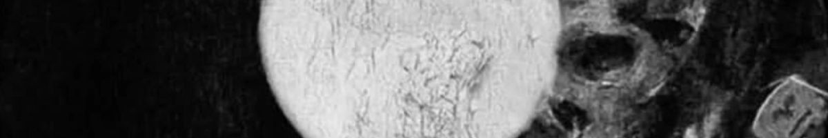 114377148748383474562 