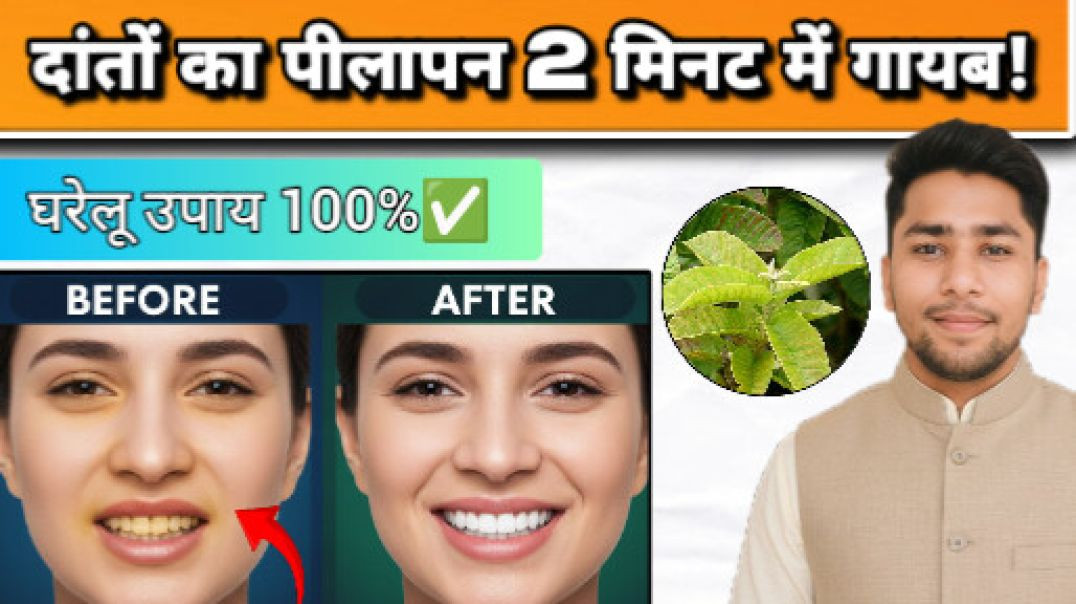 ⁣Instant teeth whitening l Teeth whitening tips in Hindi l Dant chamkane ke gharelu upay