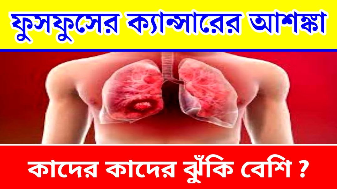 ⁣ফুসফুসের ক্যান্সার | Update Everyday | Lung Cancer