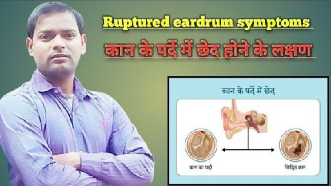 Ruptured eardrum symptoms । कान के पर्दे में छेद होने के लक्षण ।(720P_HD)