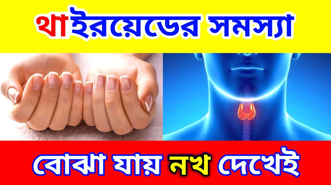 ⁣থাইরয়েডের সমস্যা বুঝে যান নখ দেখেই  | Thyroid Symptoms | Update Everyday