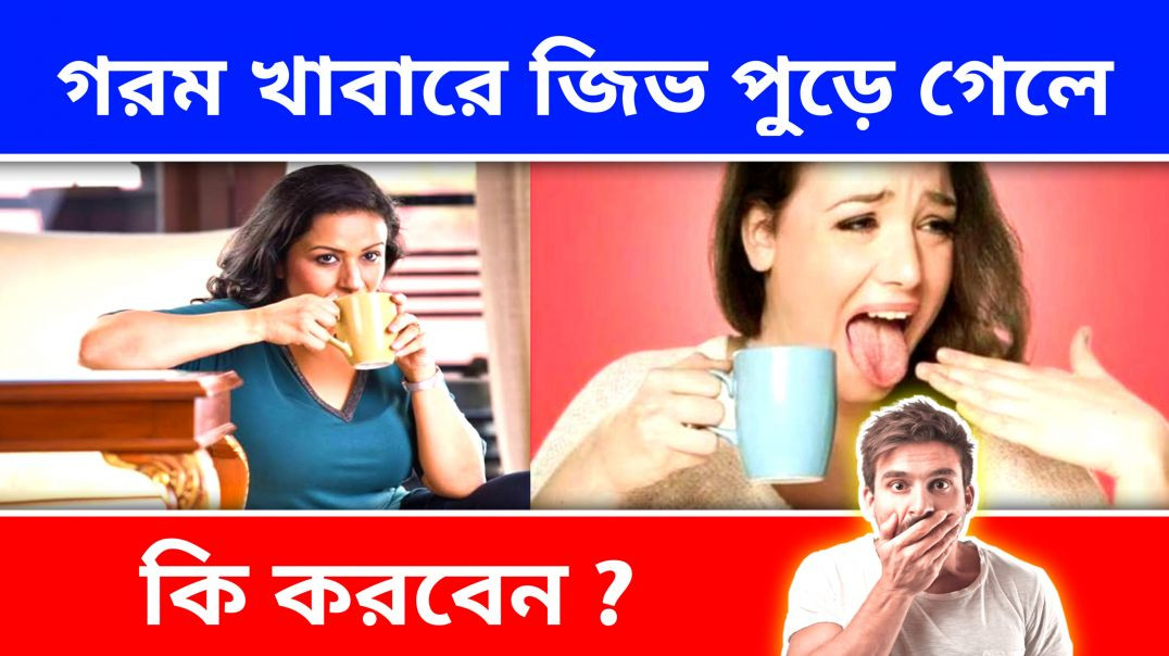 গরম খাবার খেয়ে জিভ পুড়ে গেলে কি করবেন ? | Health Tips