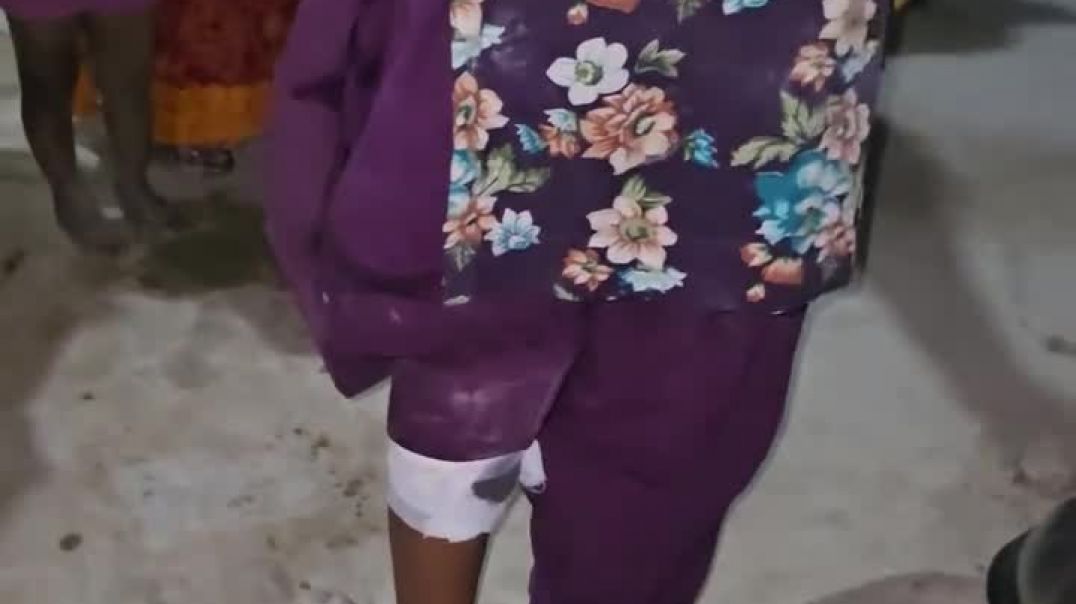 ⁣बिरकाली गांव में अभी-अभी ईंट भट्ठे पर काम करने वाली एक लड़की