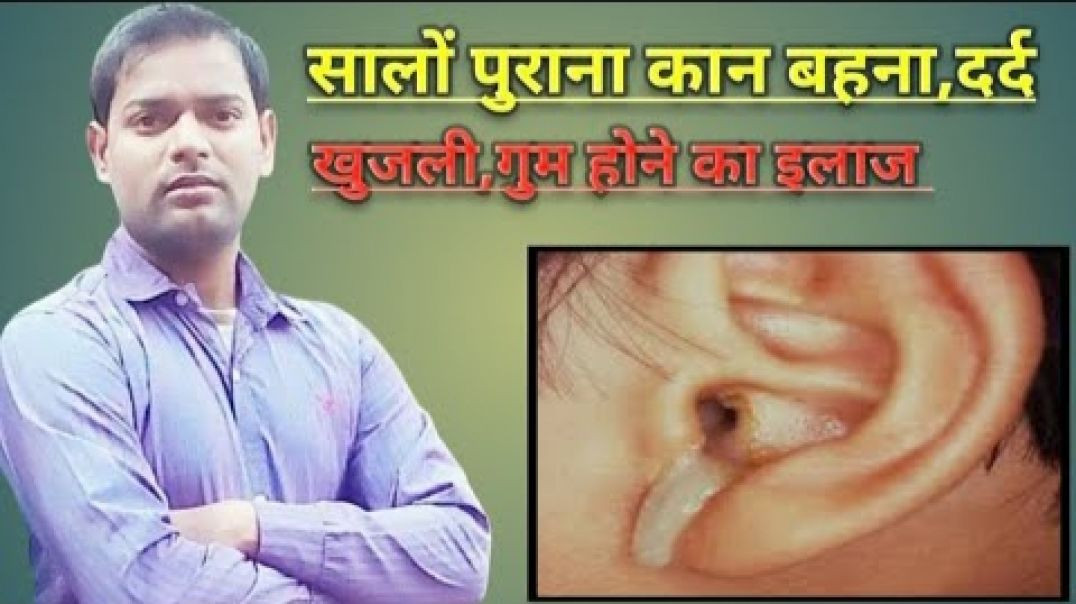 सालों पुराना कान का बहना_दर्द_खुजली_गुम होने का इलाज ।(720P_HD)