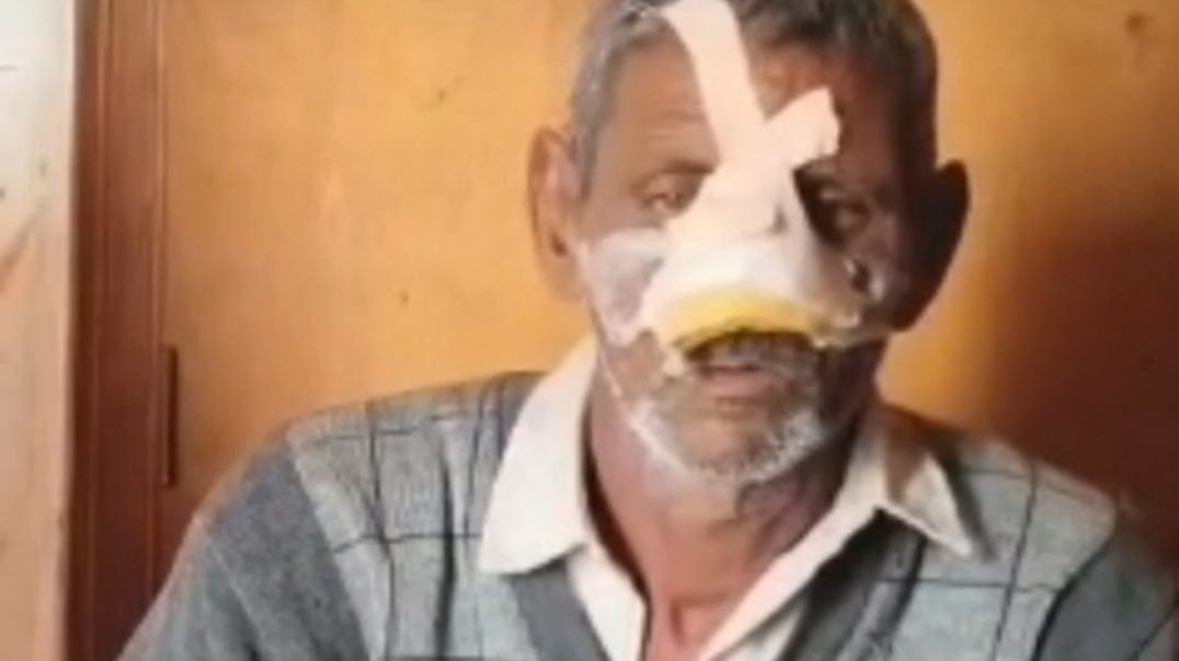 ⁣नरभक्षी जीव का आतंक