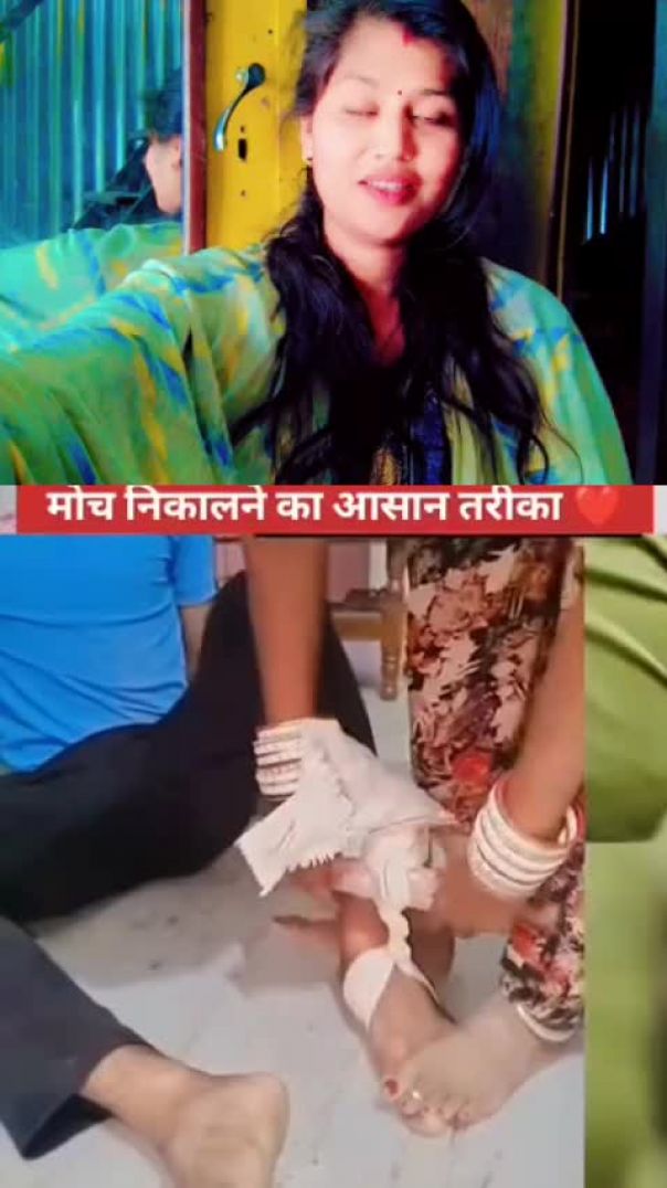 पायाचा मुडपा काढण्याची पद्धत