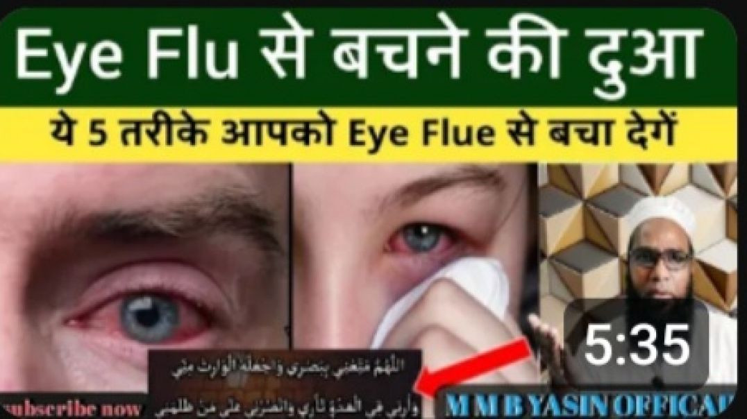⁣eye flu से बचने की दुआ _ #आंख ठीक करने का आसान और सही तरीका _# eye flu se kaise bache _ #eyeflu