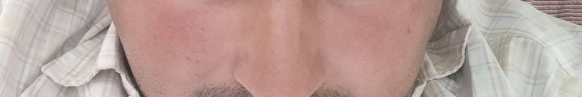 100902837177244405948 