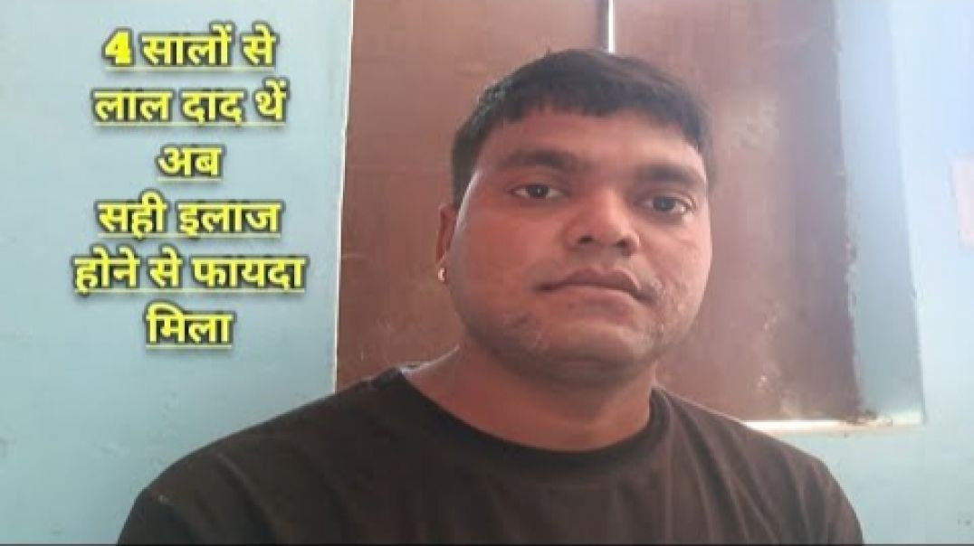 ⁣4 सालों से शरीर पर लाल दाद थें अब सही इलाज होने से फायदा मिल(720P_H