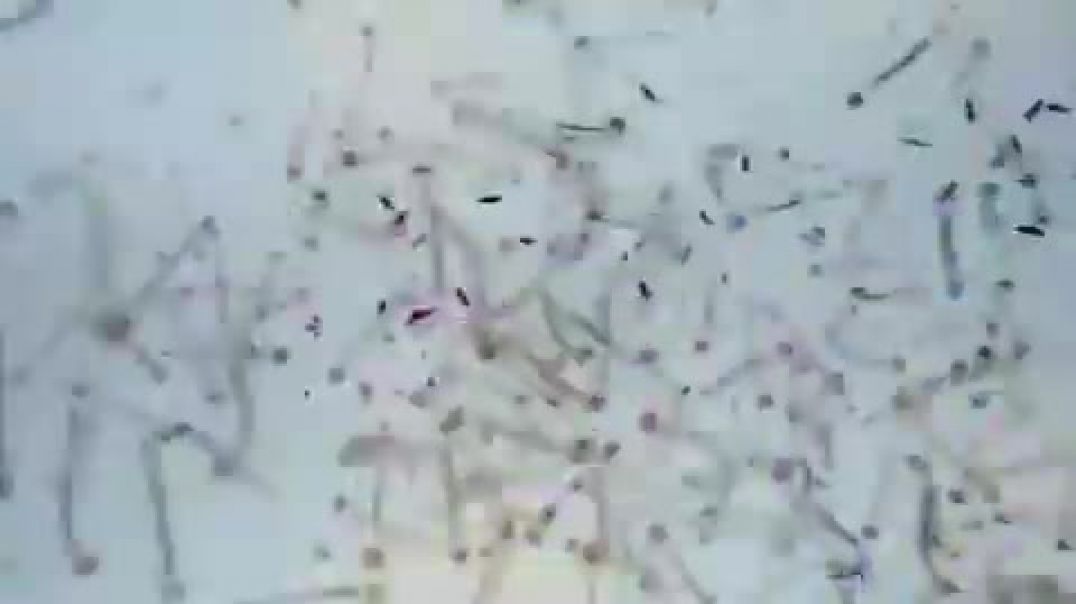 mosquitos