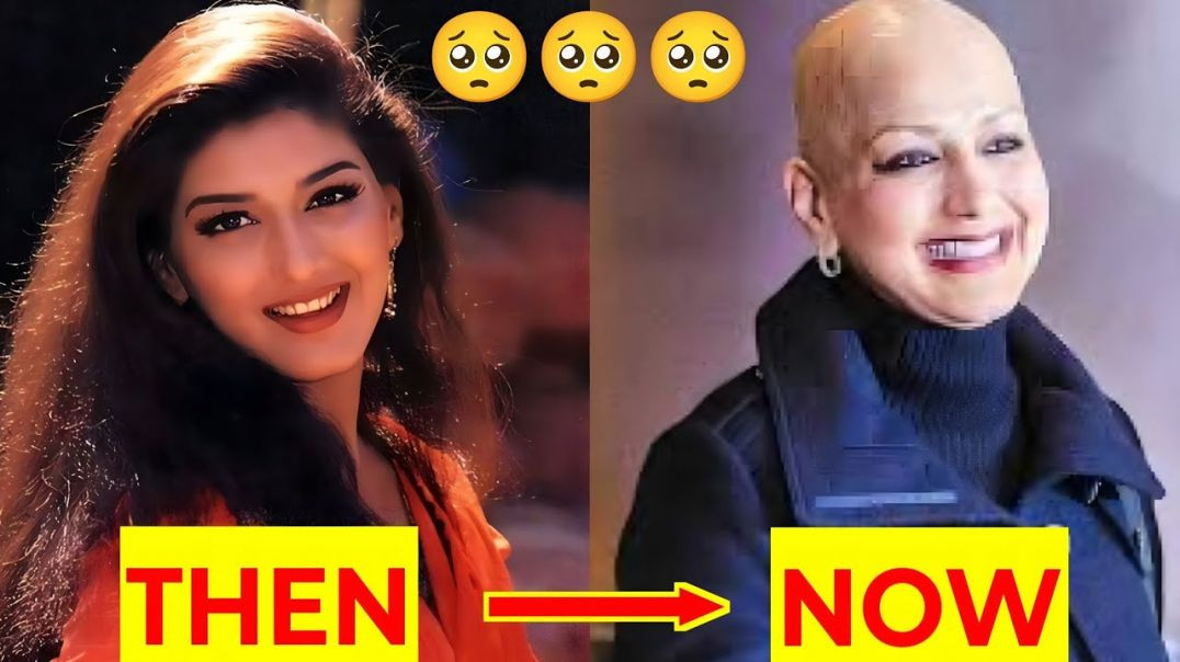⁣90s Bollywood Stars Then vs No - Part-1 You Won't Believe Their Transformation!