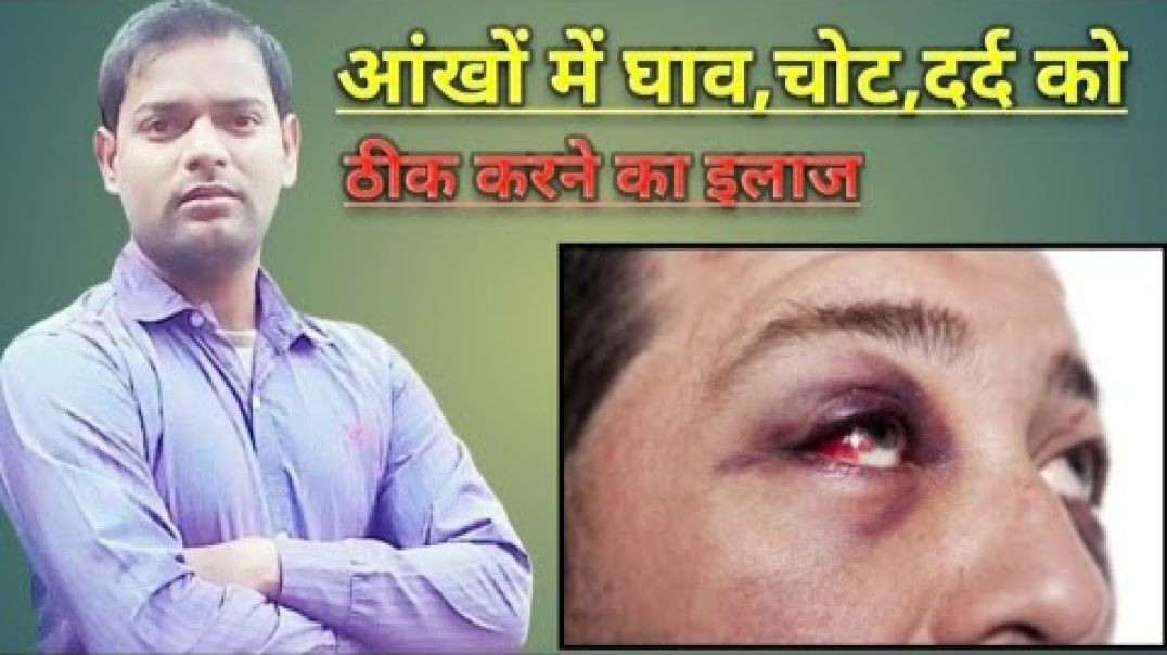 ⁣आंखों में घाव_चोट और दर्द को ठीक करने का इलाज ।(720P_HD)