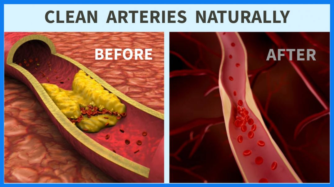 Clean Arteries Naturally